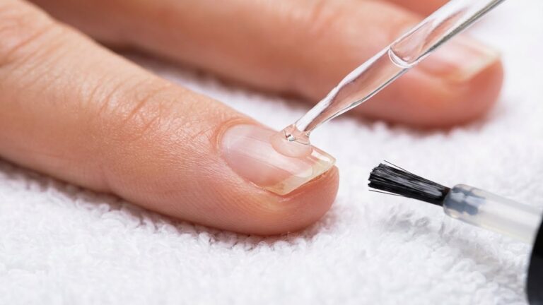 10 Best Nail Oil for Onycholysis Solutions to Strengthen and Heal Nails best nail oil for onycholysis