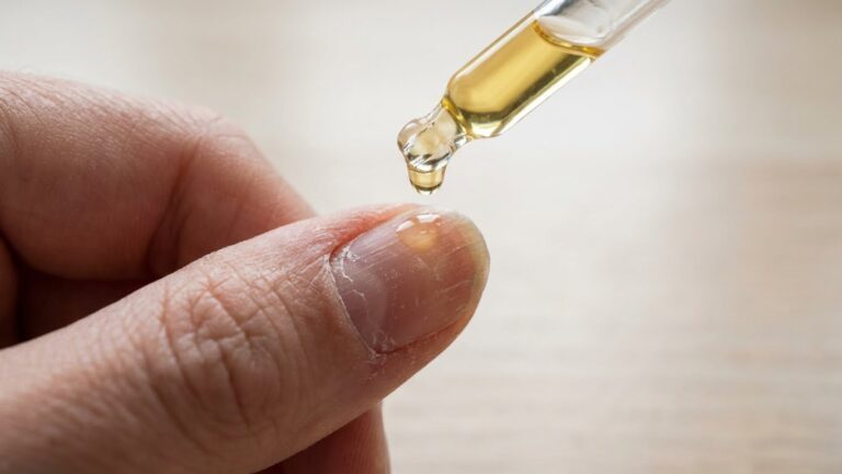 10 Best Oil for Dry Nails: Top Choices for Hydrated, Healthy Hands best oil for dry nails