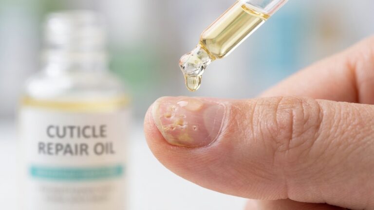 best oil for nail psoriasis