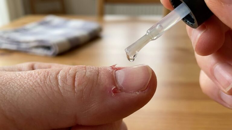 10 Best Cuticle Oil for Hangnails in 2026: Top Effective Solutions Reviewed best cuticle oil for hangnails