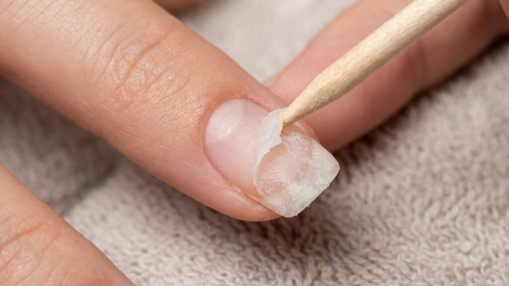 Acrylic Nail Removal Steps