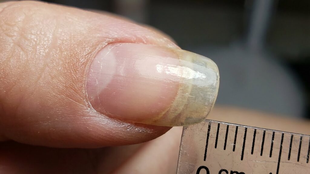 Nail Growth Impact
