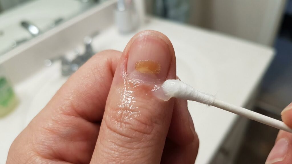 Protecting Skin and Cuticles