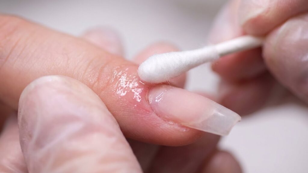 Protecting Surrounding Skin