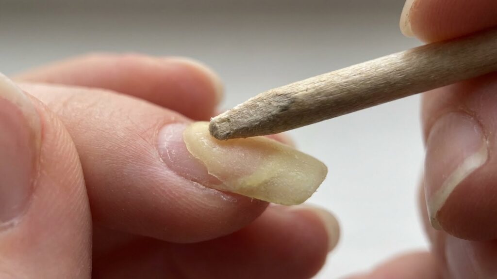 Step-By-Step Removal Process