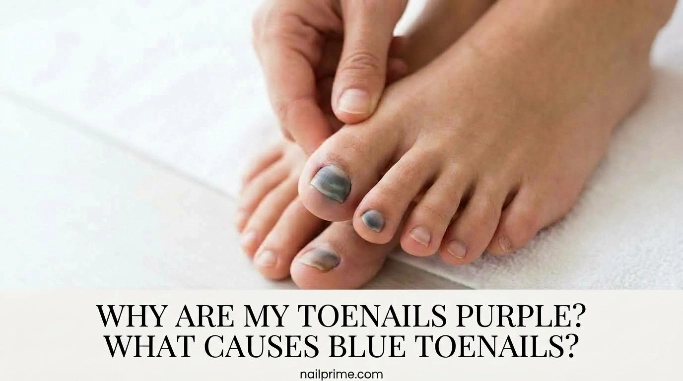 What Causes Purple Toenails