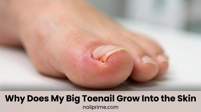 Why Does My Big Toenail Grow Into the Skin