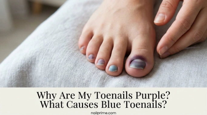 Why Does My Big Toenail Look Darker