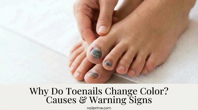 Why Is One Toenail a Different Color