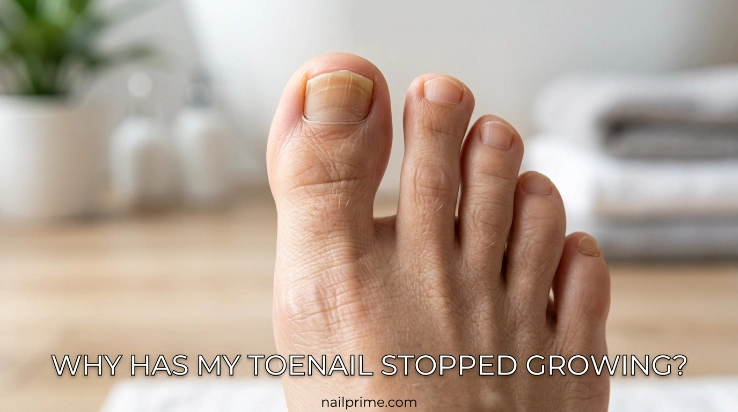 Why has my toenail stopped growing with visible slow toenail growth