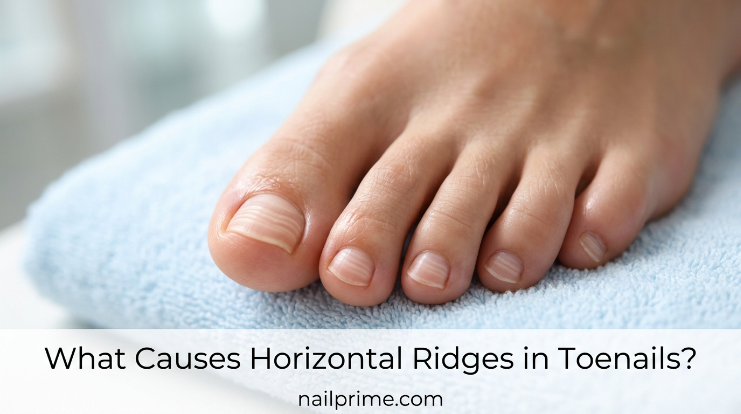 What causes vertical ridges in toenails on a healthy big toe