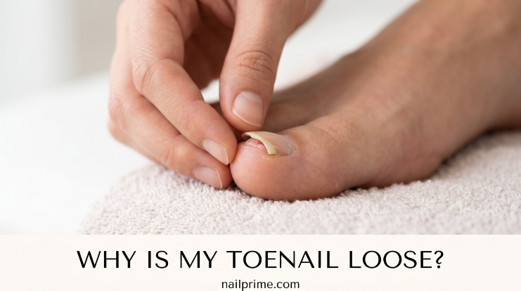 Why is my toenail lifting from the nail bed example showing mild nail separation
