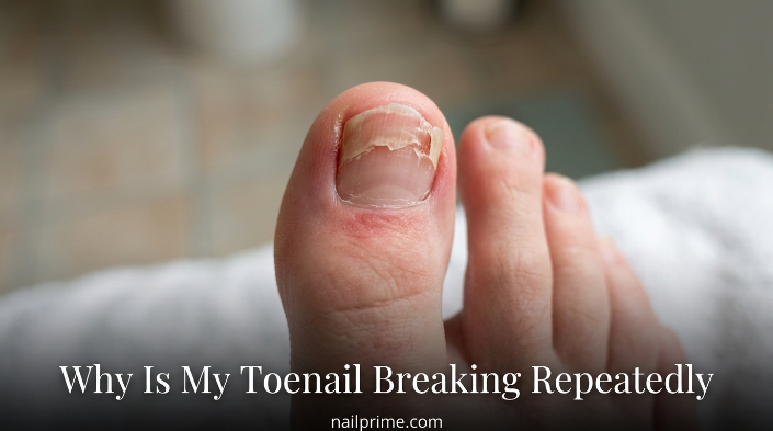 Why Is My Toenail Breaking Repeatedly