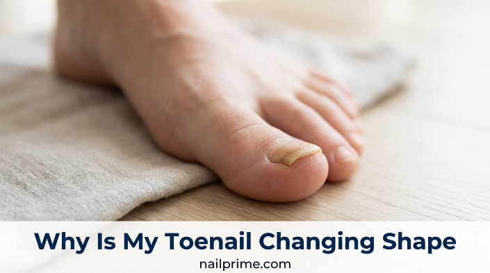 Why Is My Toenail Changing Shape